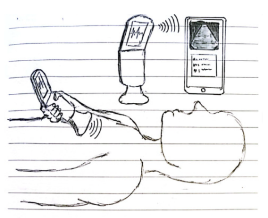 Sketch of at-home portable ultrasound concept