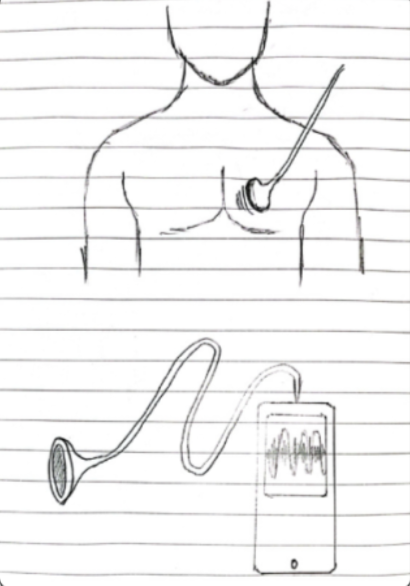 Sketch of stethoscope with automatic lung sound classifier