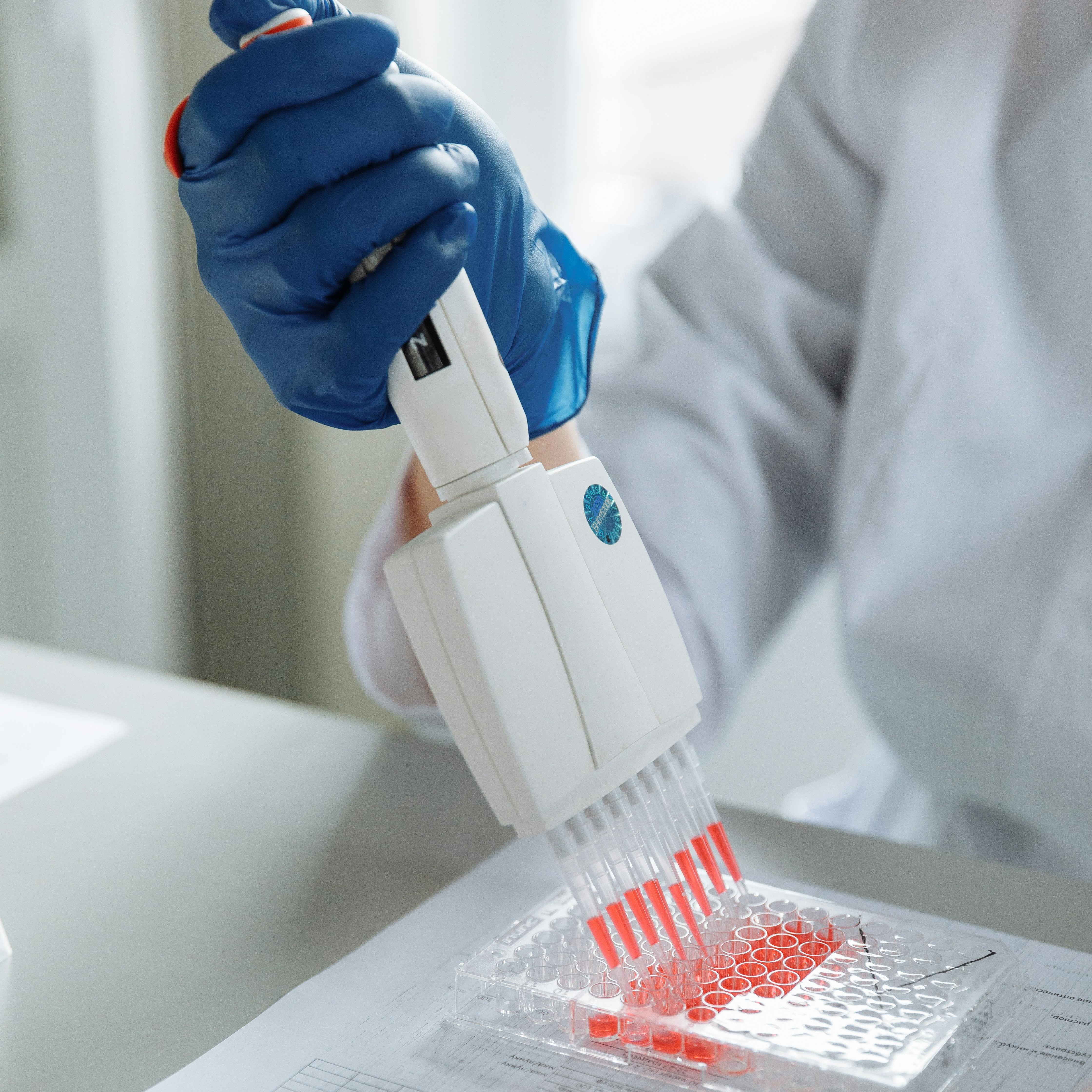 Scientist pipetting samples into a 96-well microplate — HIV biomarker immunoassay platform commercialization case study for The Wistar Institute